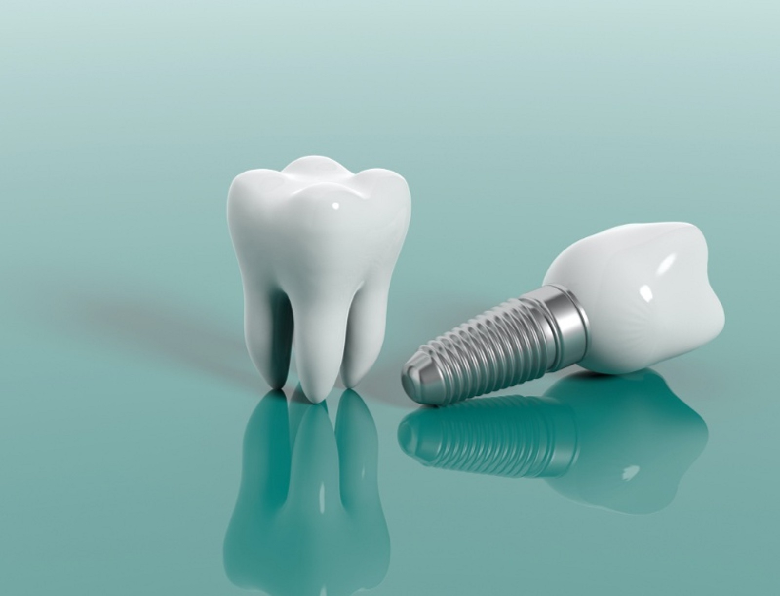 what-happens-if-you-do-not-have-enough-bone-for-dental-implants