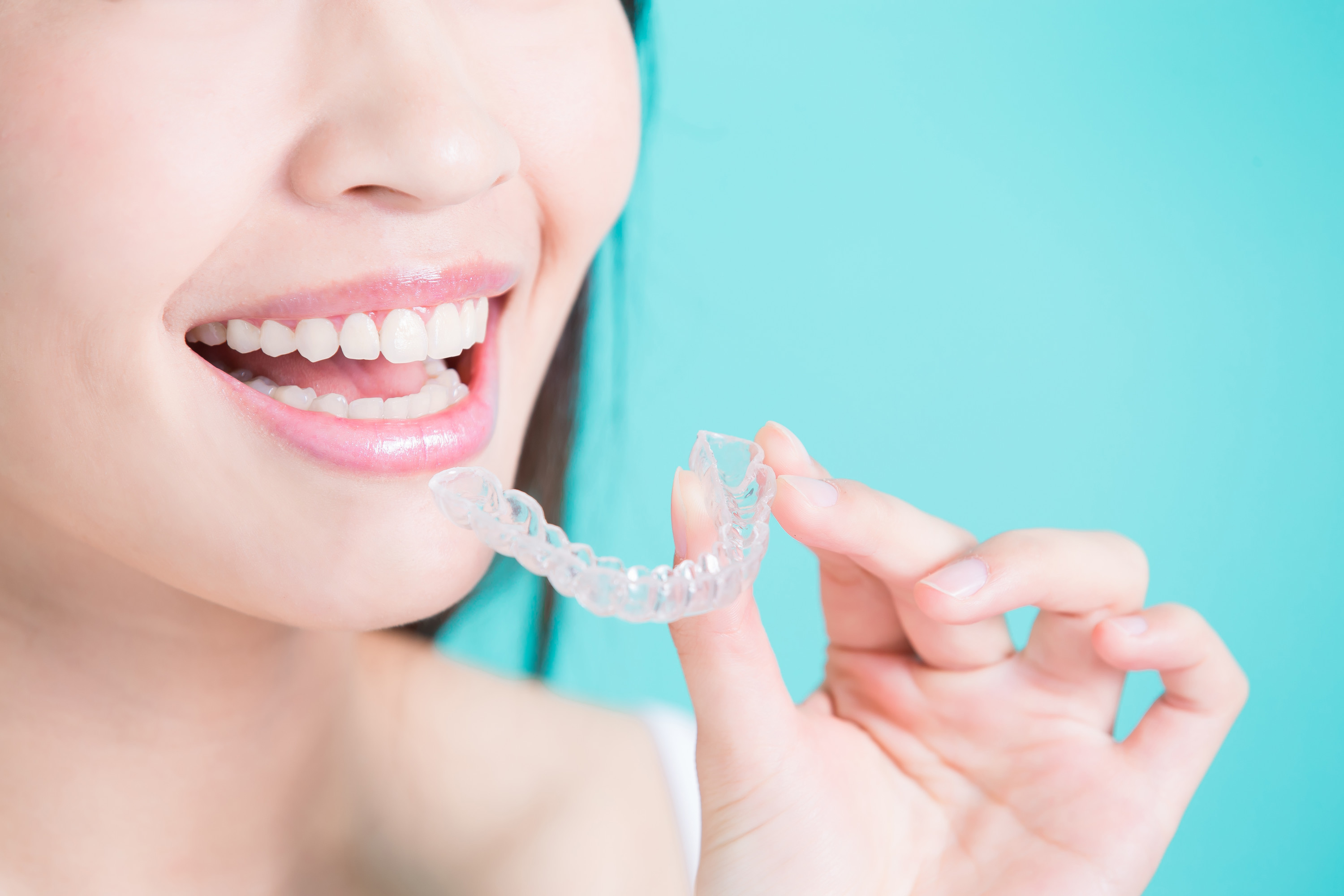 Tips for Keeping Your Invisalign Aligners Clean
