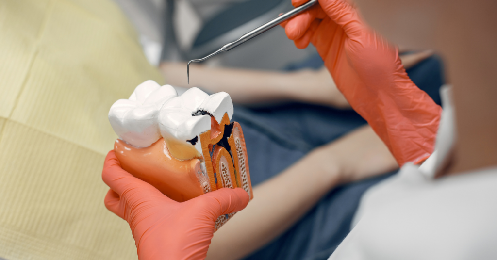 post root canal care tips for faster healing