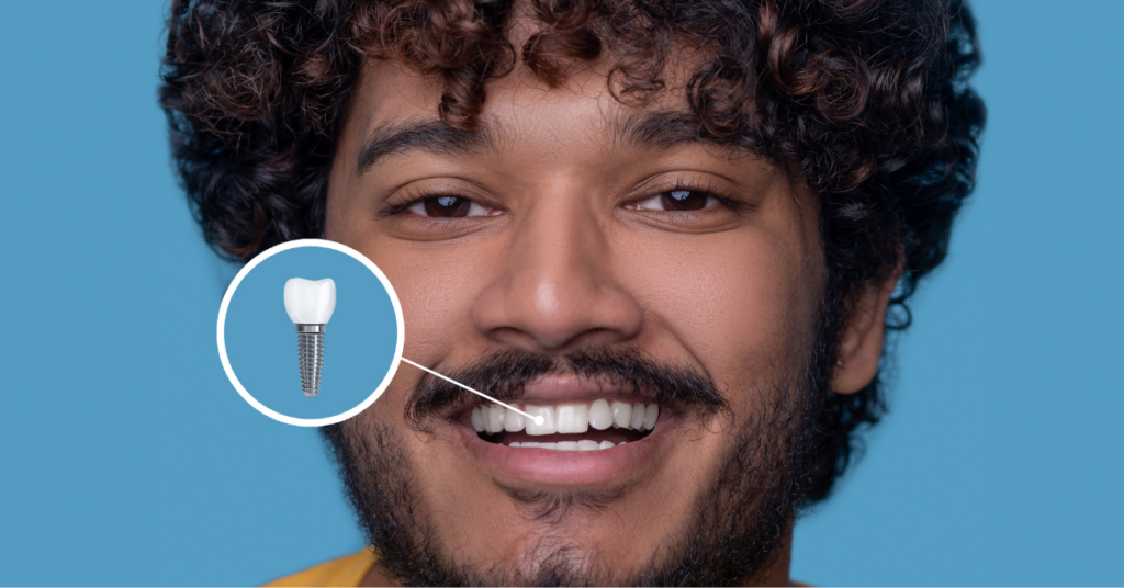 how long does it take to get dental implants