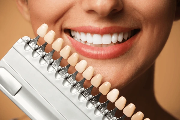 Porcelain Veneers in Edmonton