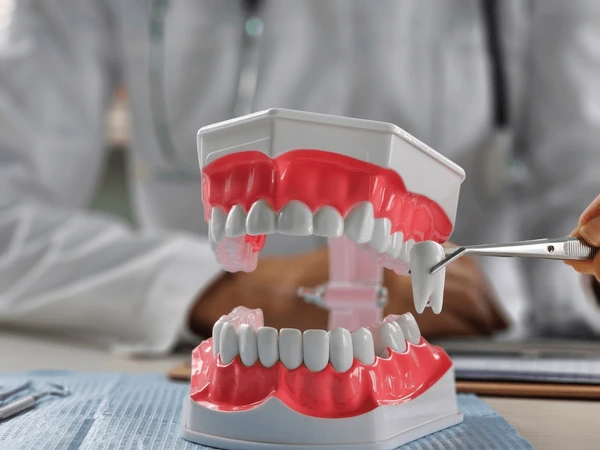 Wisdom Teeth Removal
