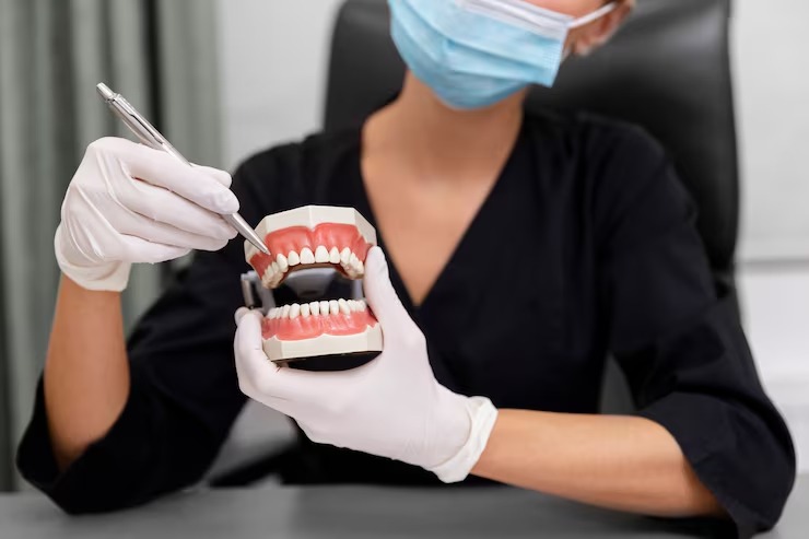 What causes the need for a root canal